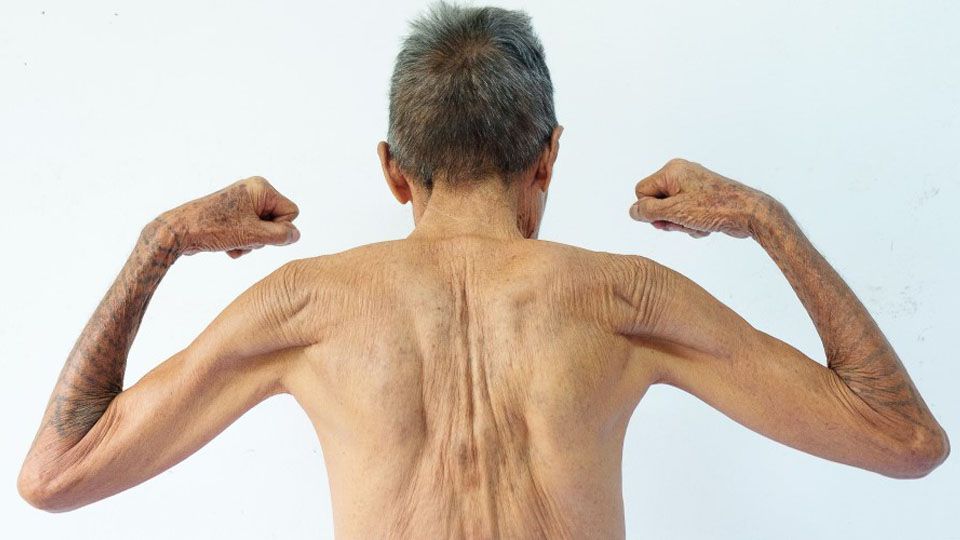 Nova substância previne perda muscular em idosos